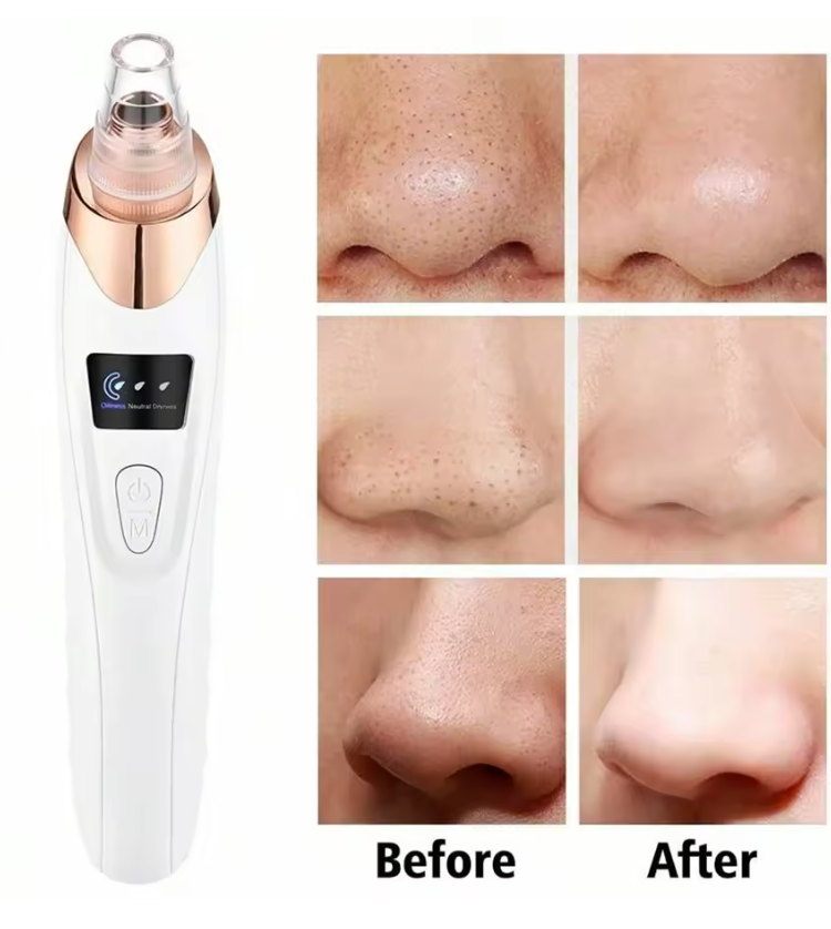 Blackhead Remover Pore Vacuum